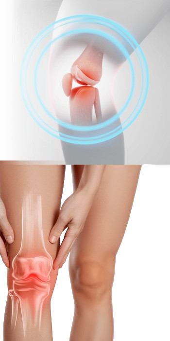 Arthronol knee pain relief supplement